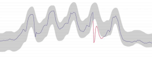 Cavisson Anomaly